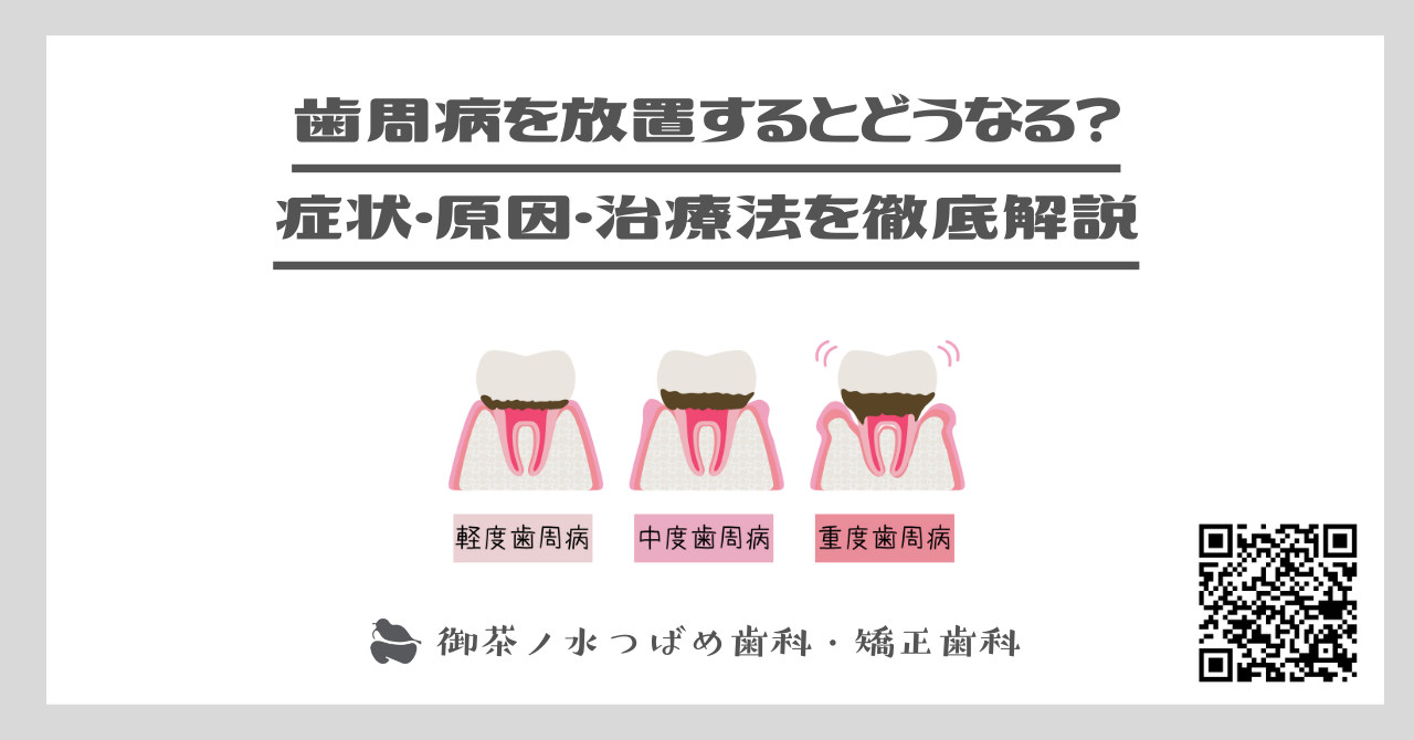 歯周病を放置するとどうなる？ 症状・原因・治療法を徹底解説