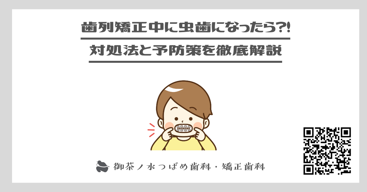 歯列矯正中に虫歯になったら？！対処法と予防策を徹底解説