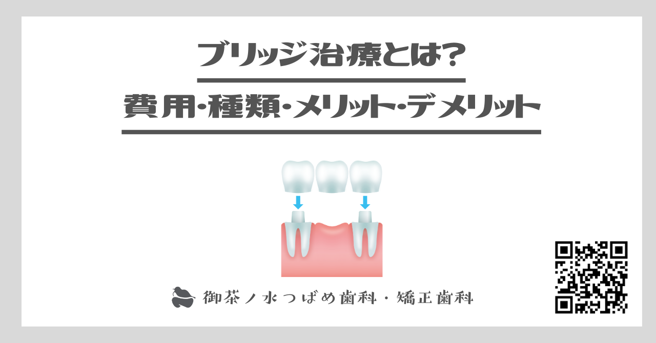 ブリッジ治療とは？費用・種類・メリット・デメリットを解説