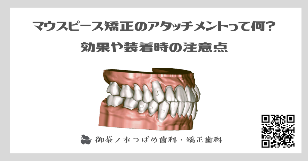 マウスピース矯正のアタッチメントって何？効果や装着時の注意点