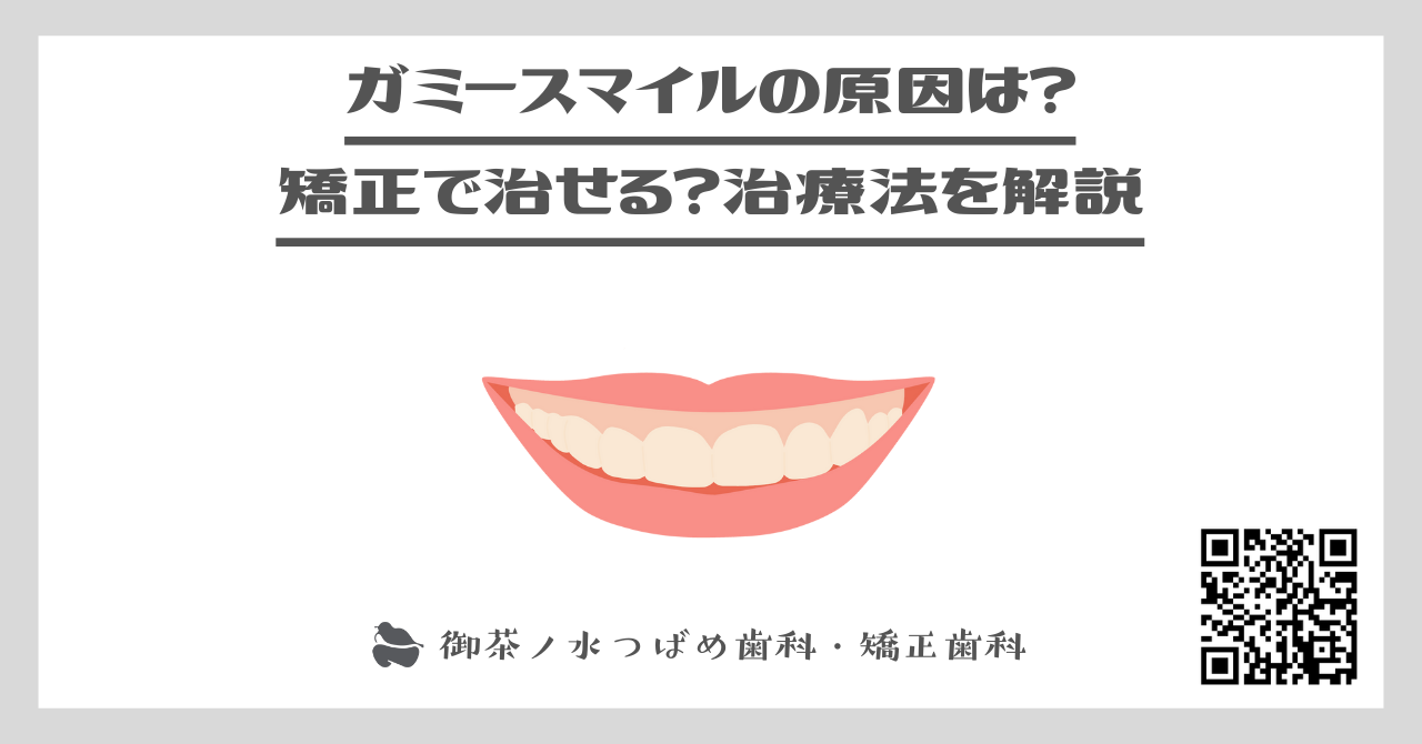 ガミースマイルの原因は？矯正で治せる？治療法を解説