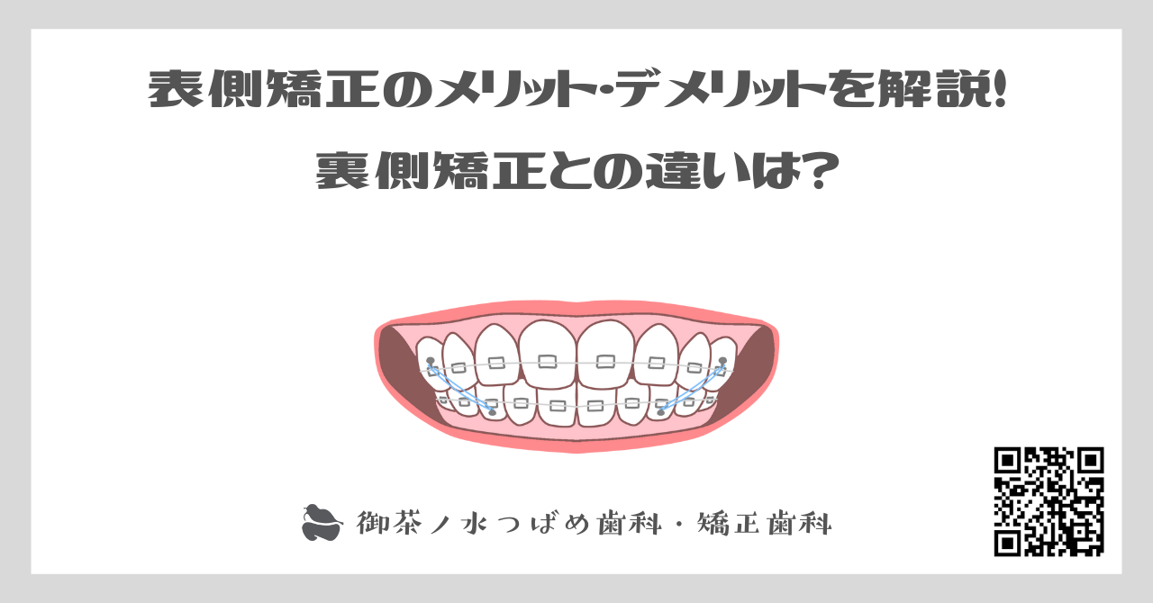 【歯列矯正】表側矯正のメリット・デメリットを解説！裏側矯正との違いは？