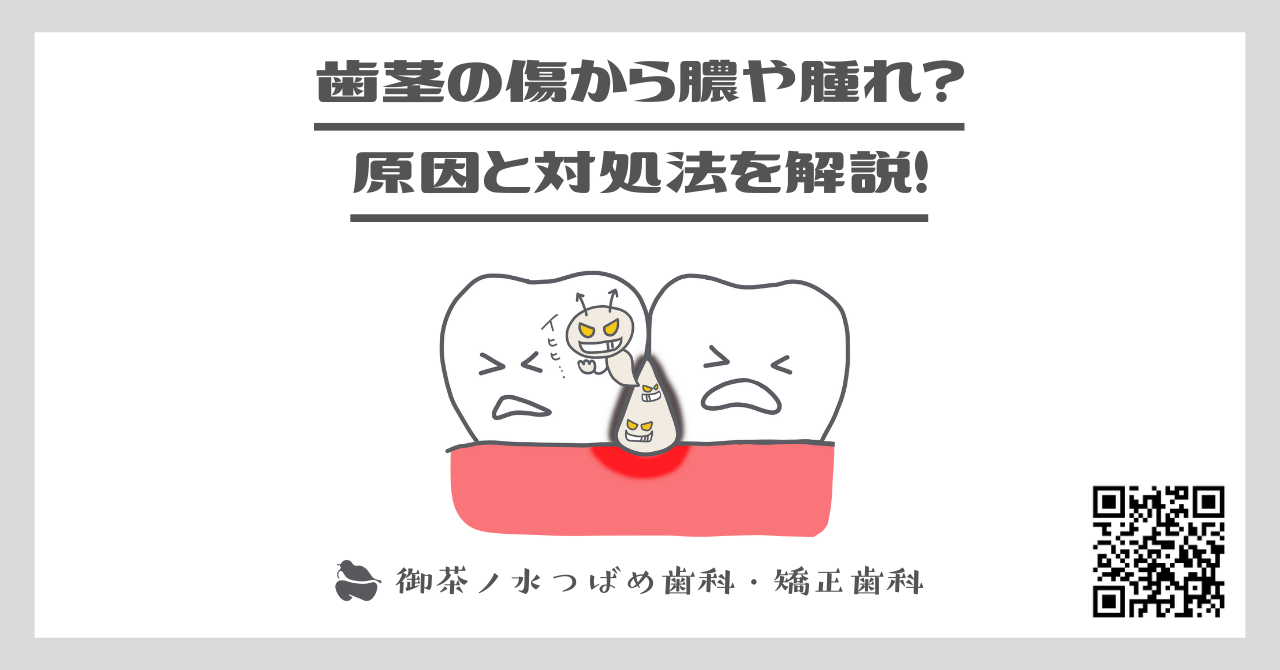 歯茎の傷から膿や腫れ？原因と対処法を解説！