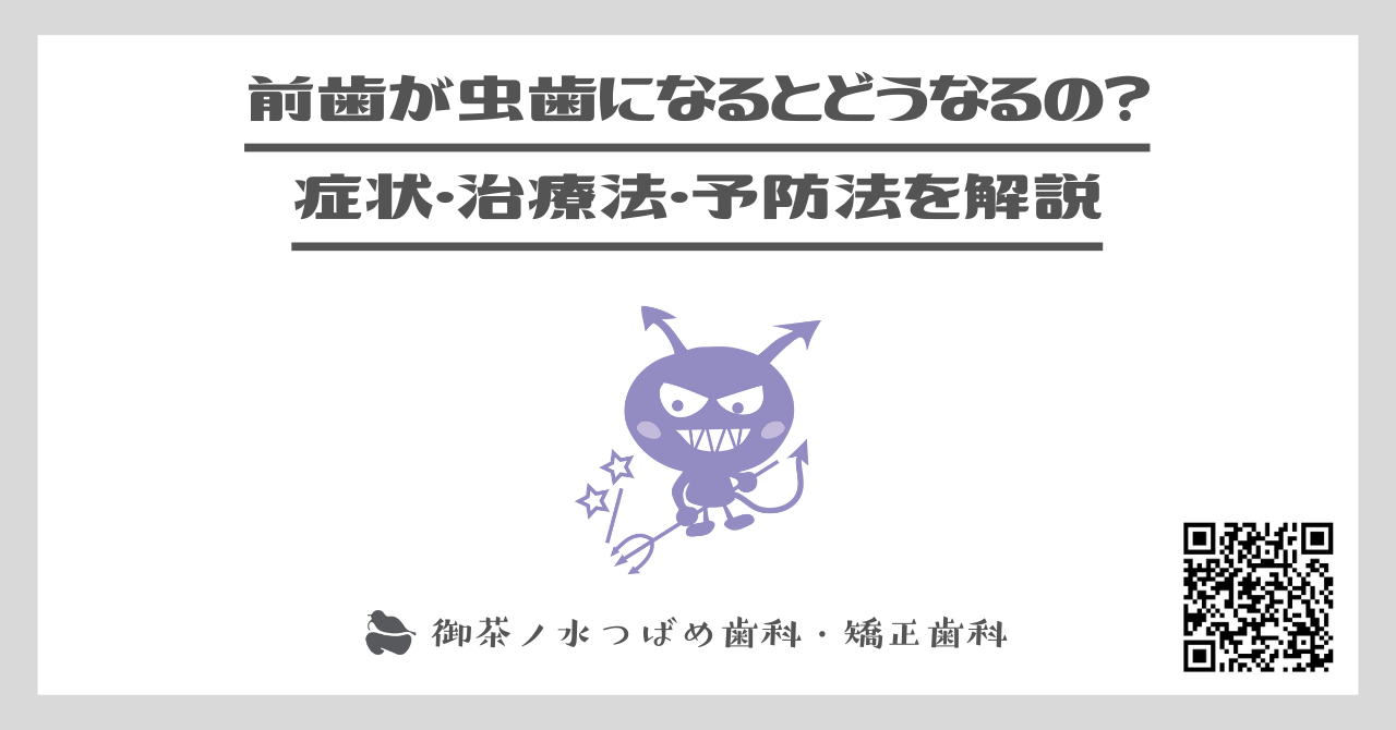 前歯が虫歯になるとどうなるの？症状・治療法・予防法を解説