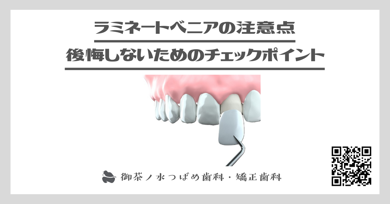 ラミネートベニアの注意点｜後悔しないためのチェックポイント