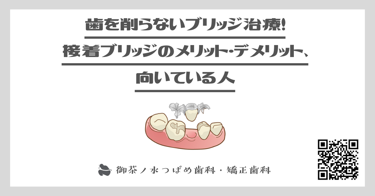 歯を削らないブリッジ治療！接着ブリッジのメリット・デメリット、向いている人