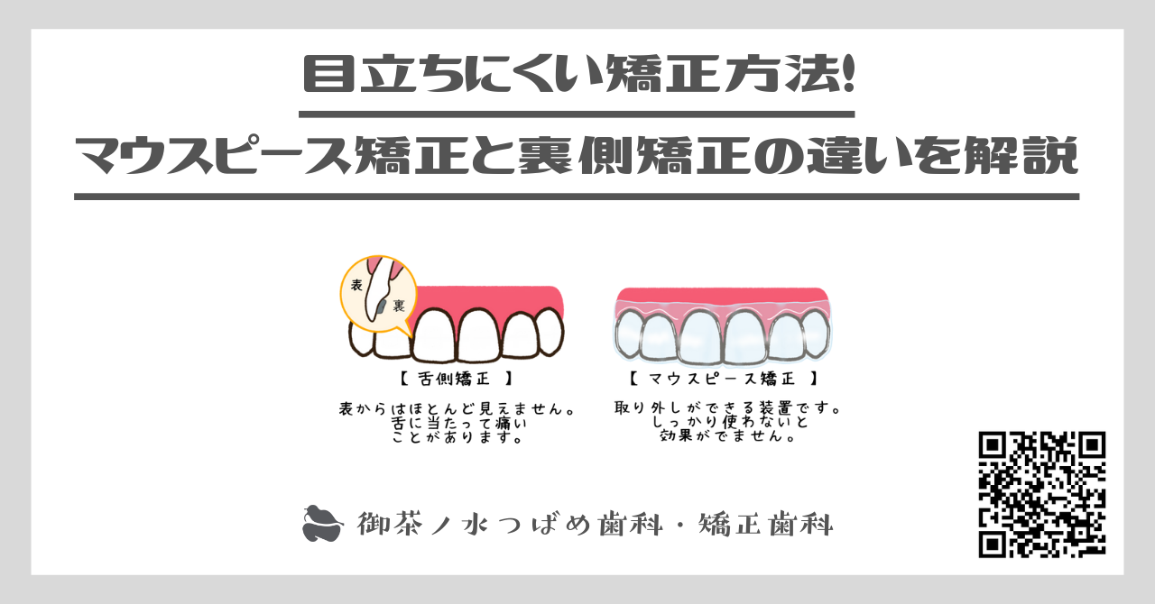 目立ちにくい矯正方法！マウスピース矯正と裏側矯正の違いを解説