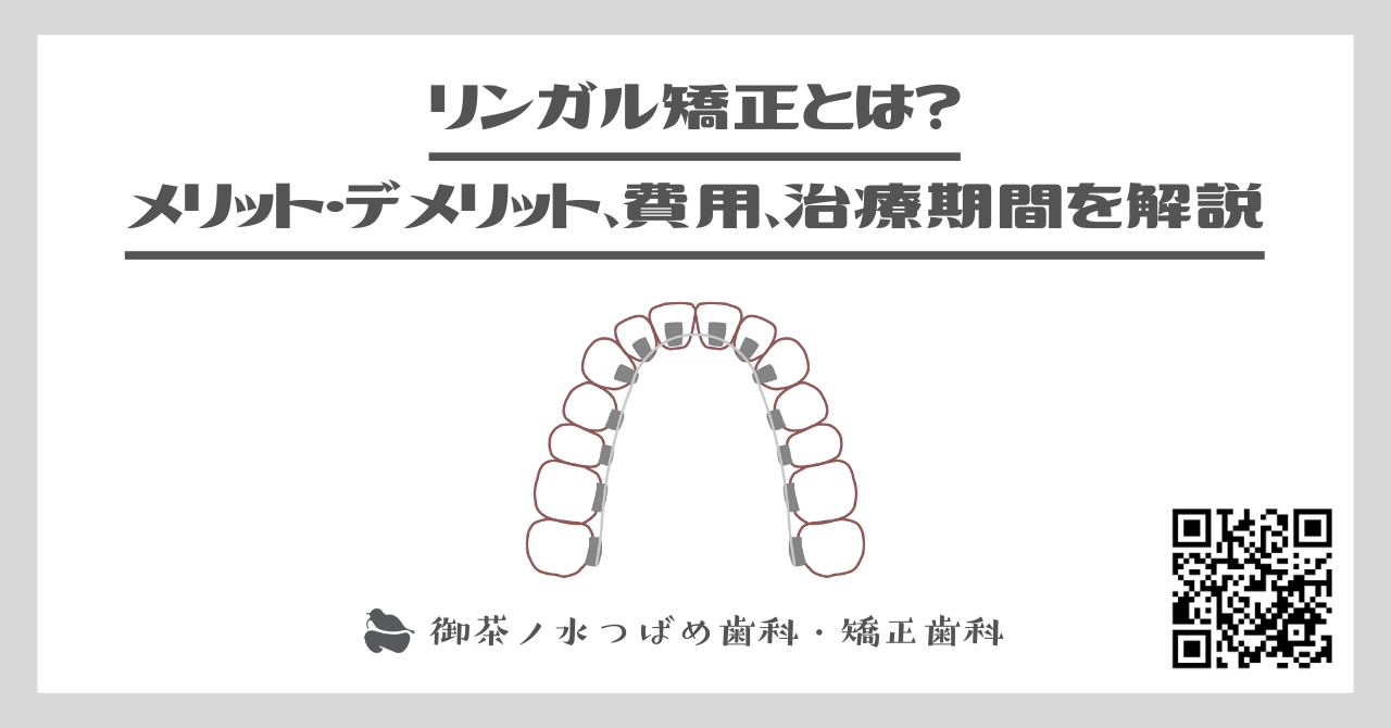 リンガル矯正とは？メリット・デメリット、費用、治療期間を解説