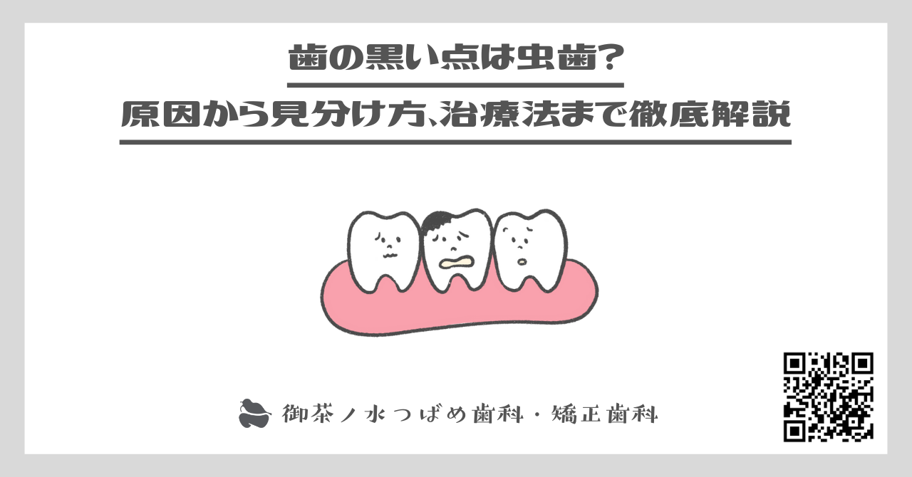 歯の黒い点は虫歯？原因から見分け方、治療法まで徹底解説