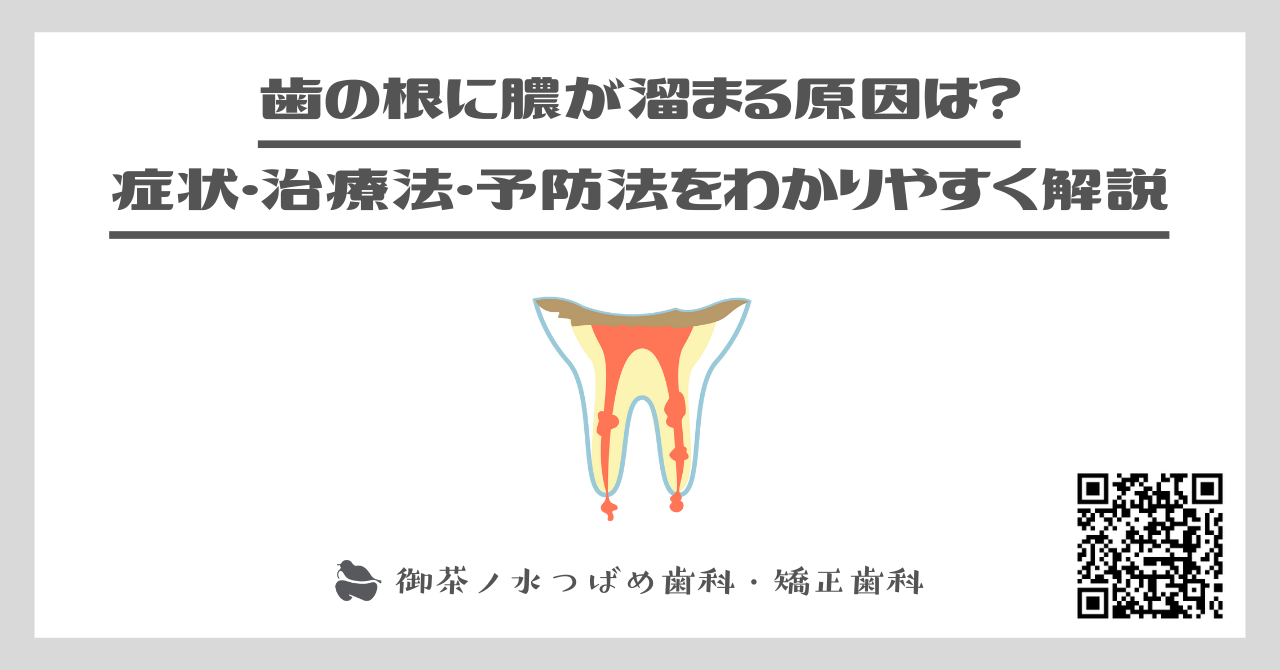 歯の根に膿が溜まる原因は？症状・治療法・予防法をわかりやすく解説！